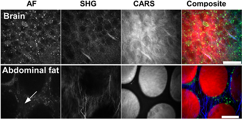 Better Detection Of Cancerous Cells With Multimodal Imaging